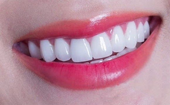 Không phải răng trắng tinh là tốt cho sức khỏe